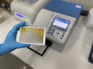 精準檢測「硫酸吲哚酚」輔助評估腎功能，對於腎友共病發展及潛在心血管風險，具有重要參考價值。（資料來源：偉喬生醫）